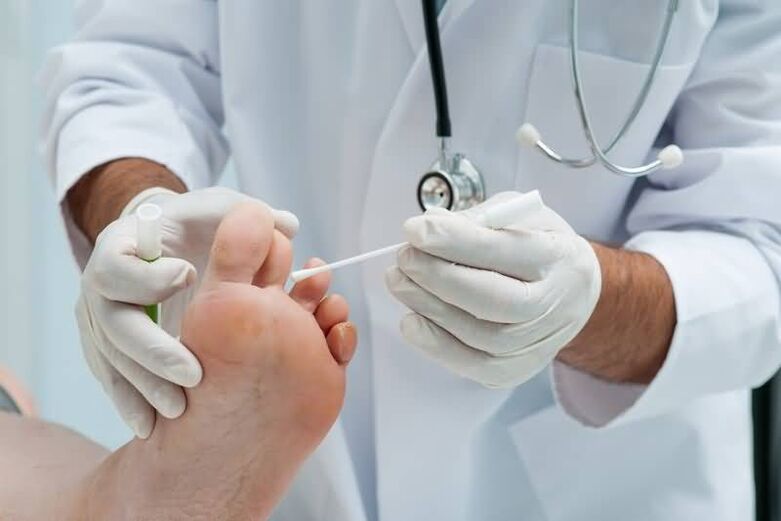 Ако имате симптоми на гъбички по ноктите на краката, трябва да се консултирате с дерматолог или миколог. 